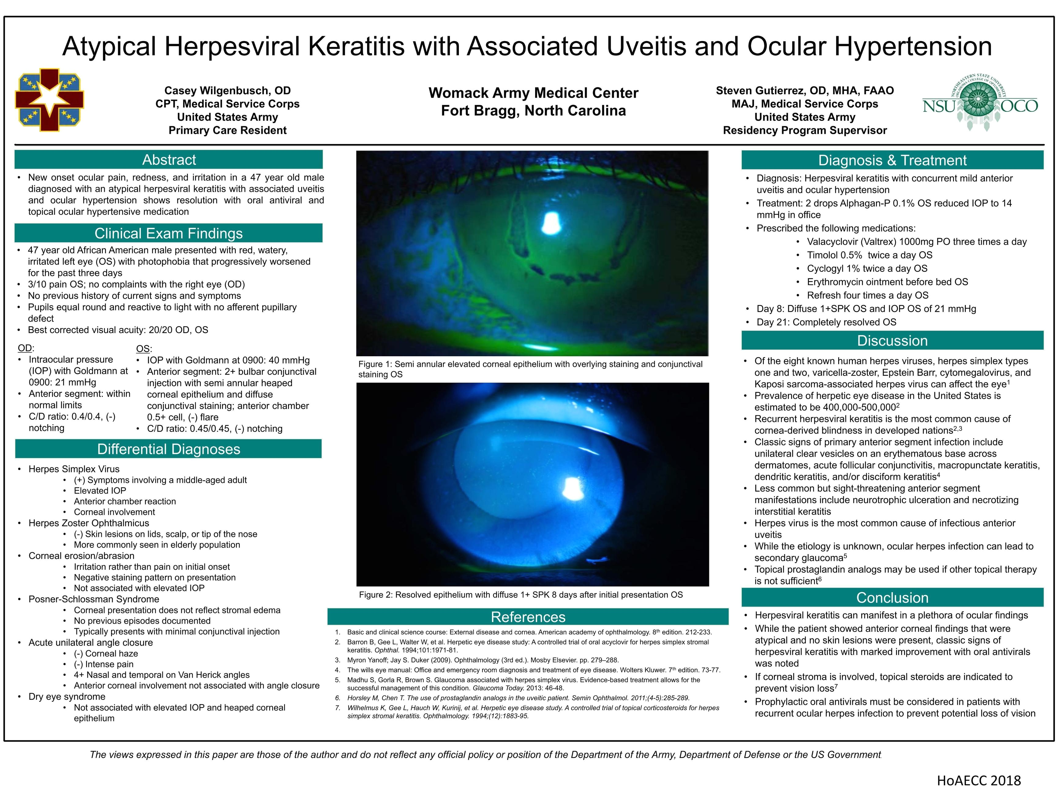 atypical herpesviral keratitis with associated uveitis and ocular hypertension