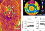 Arrow Of Light Awards Age but Not Short Term Intensive Swimming Affects Chondrocyte