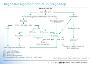 First Floor Maternity Uhw Venous Thromboembolism In Pregnancy Ppt Video Online Download