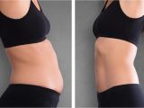Lipo Light Treatment Does Light therapy Work for Weight Loss Clarksvillenow Com