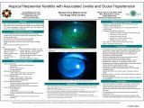 Woods Lamp Eye Exam Cpt Heart Of America Eye Care Congress 2018 Poster Award Winners